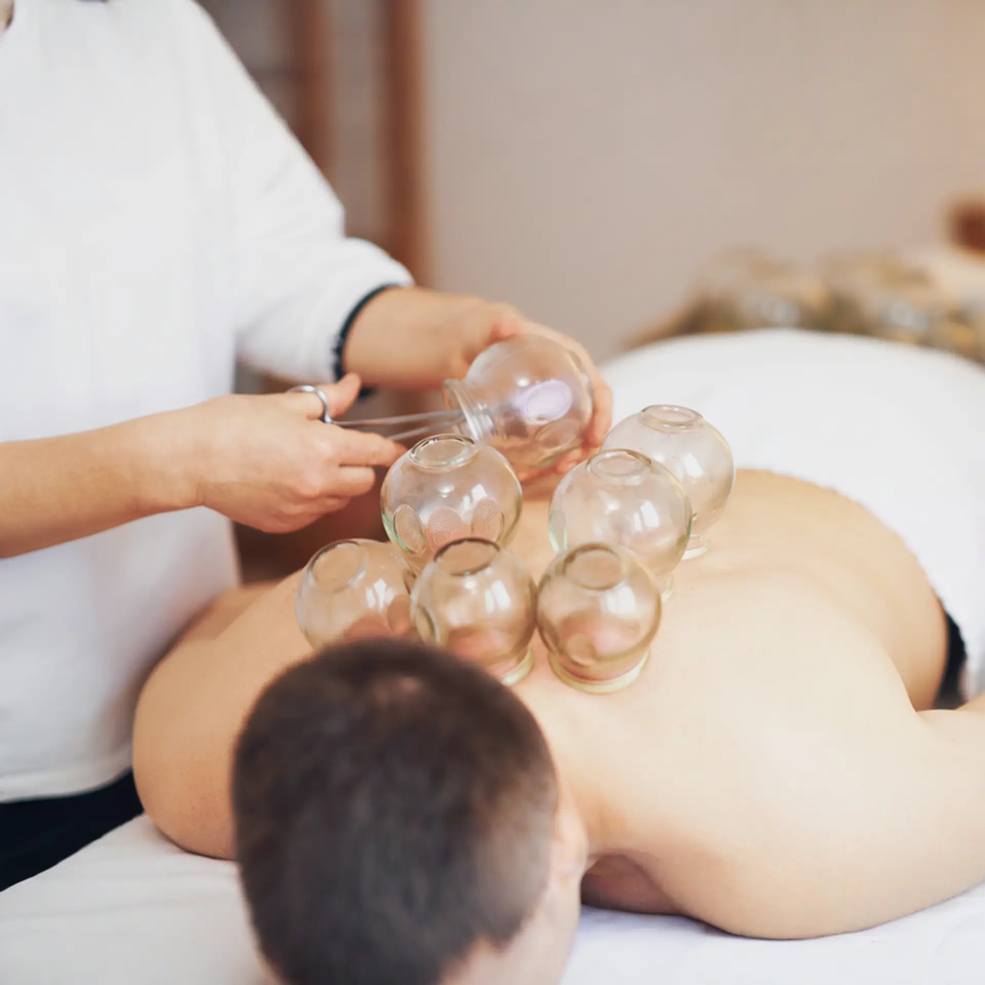 Cupping Therapy